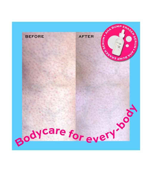 Revolution Skincare - *Body Skincare* - Sérum corporal AHA Bump Eraser - Image 5